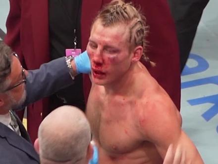 太抗揍了,脸已经面目全非#帕迪#ufc324