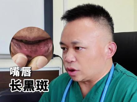 患者嘴唇带有黑斑,很有可能是波伊茨-耶格综合征,又叫色素沉着息肉综合征,有可能是家族性息肉病。#黑斑 #消化内科万荣 #息肉 #肠镜 #抖出健康知识宝藏