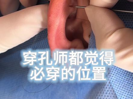 谁说Flat穿孔不痛 之前真给我疼哭了#穿孔师 #flat穿孔 #耳骨钉 #耳蜗钉 #穿孔过程