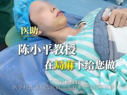 只是做了个peek下巴,还原美貌 #下巴后缩 #peek下巴 #下巴假体 #下巴手术 #下巴填充