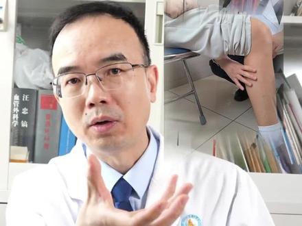 怀疑小腿肌间静脉血栓,医生怎么体检