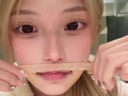 术后护理视频 #人中窝加深 #嘴角上扬 #人中三件套