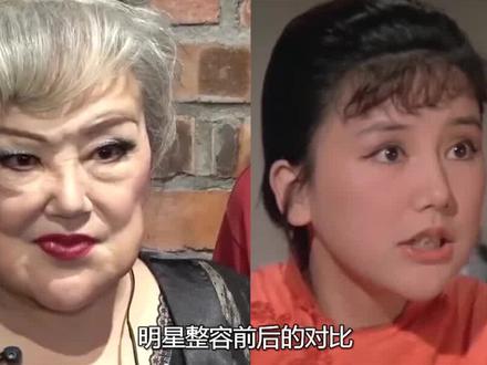 女星整容前后对比 张檬自毁前程 鞠婧祎说谎 #女演员 #娱乐评论大赏