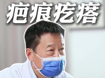 胸前疤痕疙瘩,切除+放射来解决。#疤痕 #疤痕疙瘩 #郑州治疗疤痕疙瘩 #郑大一附院崔正军