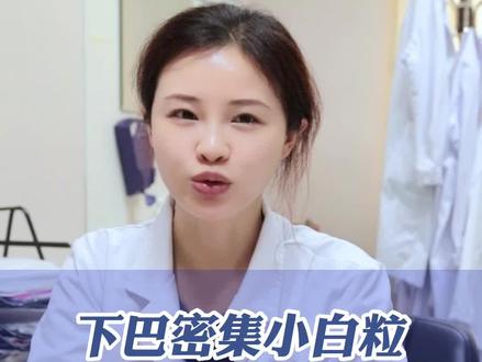 发现自己的下巴有密密麻麻的小白粒,挤还能挤出一些东西,可能是白头粉刺,别急,这个方法教你如何改善#白头粉刺 #皮肤 #黑头 #痘痘 #科普