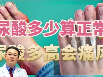 尿酸多少算正常?多高会痛风?尿酸再高,不发作痛风就没事儿吗?#高尿酸血症 #硬核健康科普行动 #痛风