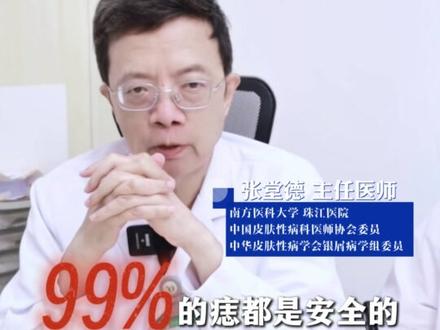 身上痣激光还是手术切除?超详细攻略,帮你梳理清楚! #痣 #黑色素瘤 #脚底痣 #切痣 #抖音精选