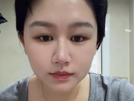 #替尔泊肽 麻烦大家慎重点吧!