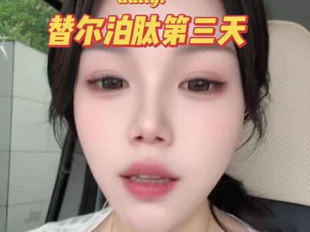 #记录生活吐槽 #替尔泊肽副作用 有没有宝子们跟我一样,没反应的? 打之前我超级怕有不适感影响生活上班,目前这三天的感觉真的很舒适,希望能保持住舒适感……哈哈哈