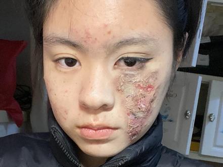 这种烧伤怎么画?
#烧伤妆 #特效妆 #妆教