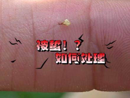 被蜜蜂蜇了怎么办?今天香香以身试法,教大家如何处理。#蜜蜂蜇伤后急救小常识#养蜂人#动物咬伤处理