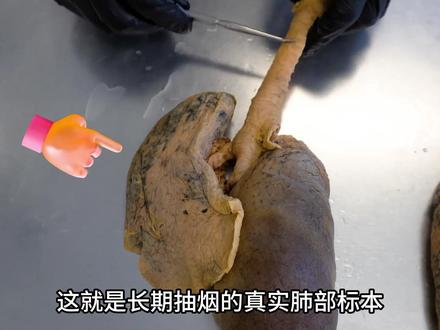 戒烟一个月你的身体会有什么变化?#科普