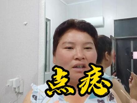 三嫂在网上买了瓶点痣膏,自己亲身体验什么感受,相信效果会不错 #家庭日常 #点痣