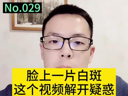 脸上起白斑,你不要害怕#白癜风 可能是#白色糠疹 #白斑 #皮肤问题 #医学知识科普