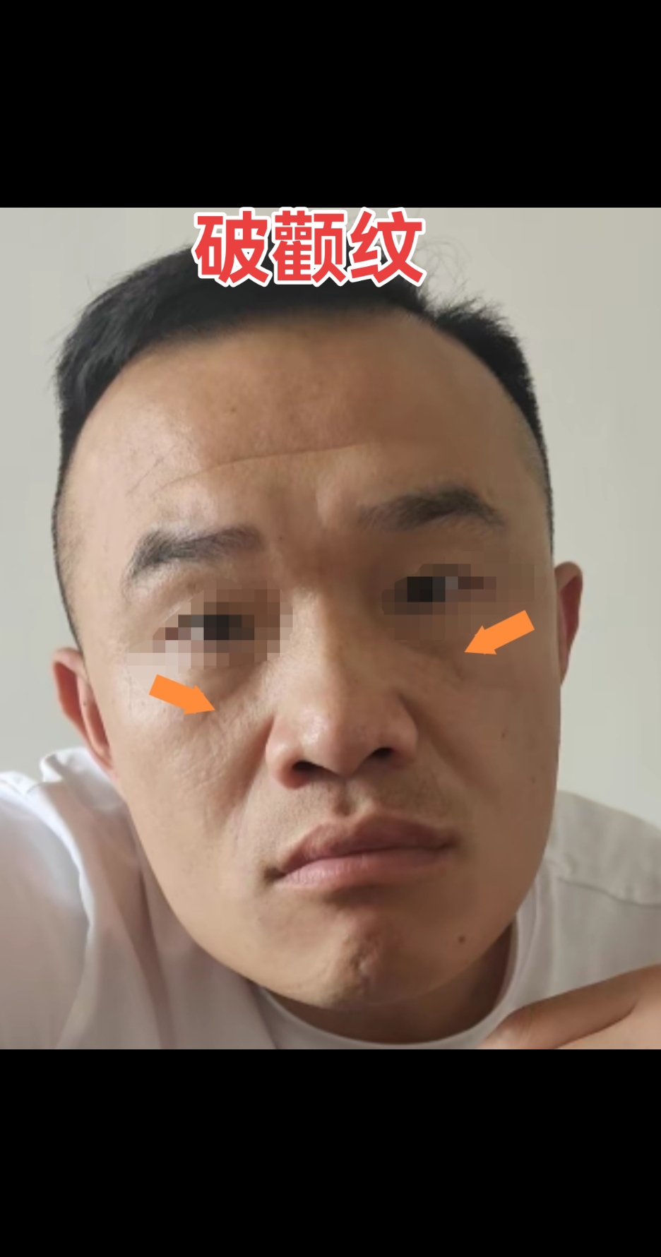 主权利和控制力,颧骨处有一条斜纹穿过,即破颧纹,男人有此纹克权,非常