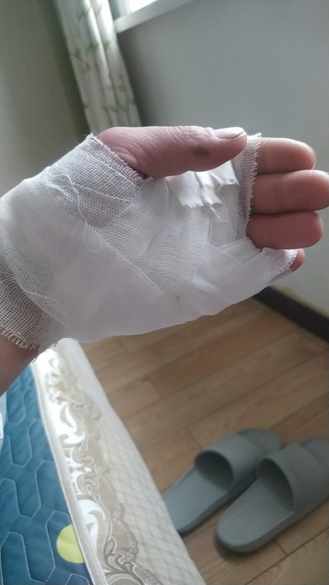 乡村吕大笨:缝了六针, 摸鱼能把手摸成这样,我想知道我摸到啥了