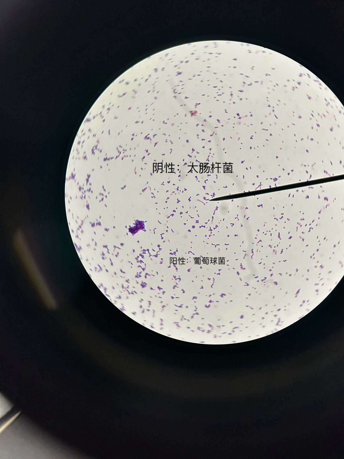 陈玟瑾:免疫学实验(革兰阳染色法)图示:阳性(蓝紫色):葡萄球菌 阴性