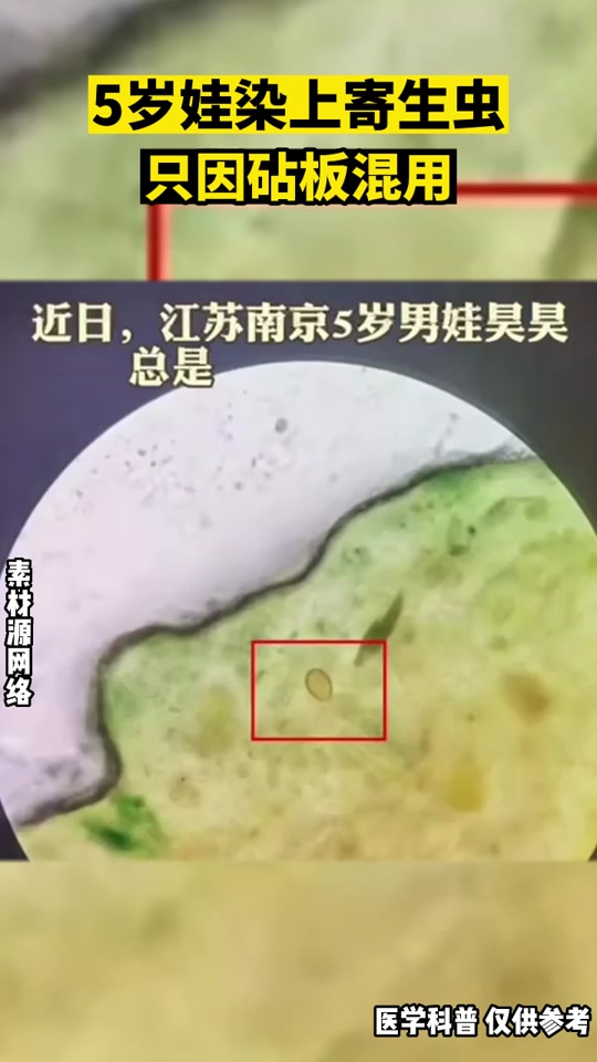 男孩肚子长满寄生虫