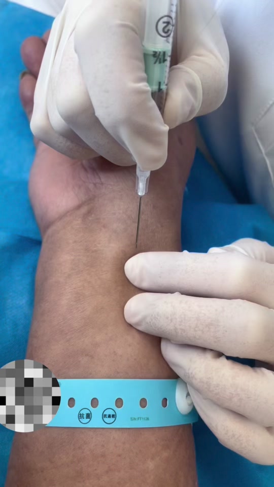 动脉采血采多少毫升