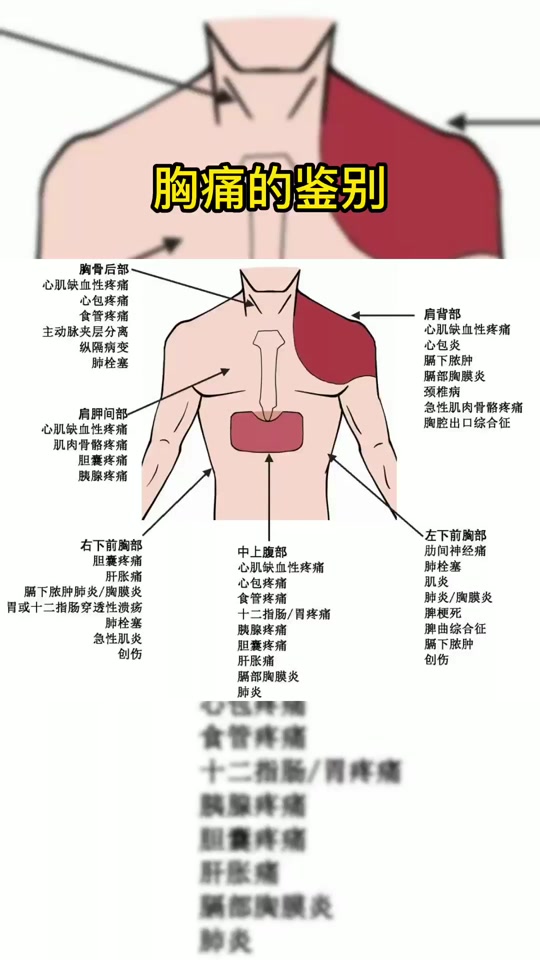 阳了会胸腔疼吗_胸腔上口疼为什么_胸腔疼痛位置图 - 抖音