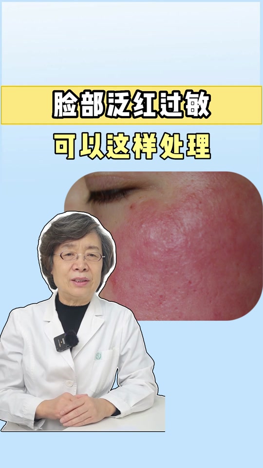 吃芒果过敏脸上起疙瘩怎么解决 - 抖音