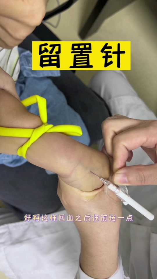 留置针双手退针_留置针双手退针方法_留置针单手退针 - 抖音