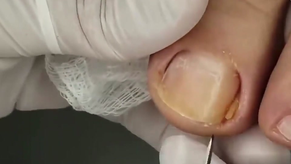 小姐姐挑战抠脚_秒变抠脚大师搞定她18分钟_抠脚大师爆米花 - 抖音