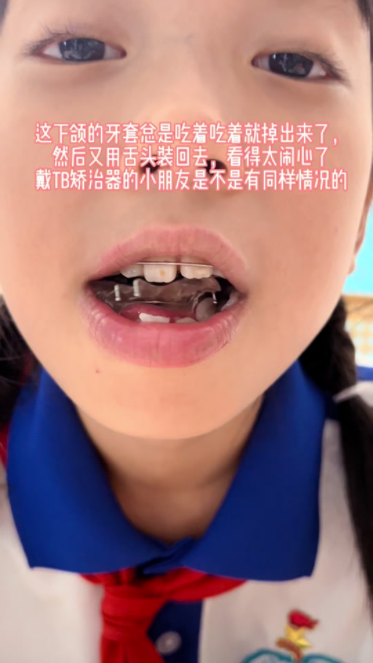 tb矫正器吃饭用摘下来吗