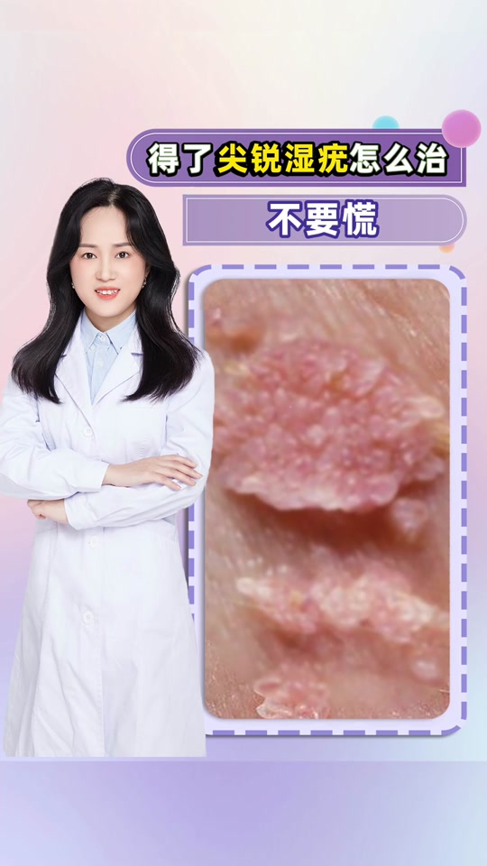 菜花状疣体是不是已经很严重了_菜花状疣自己抠掉了_女性菜花状疣体