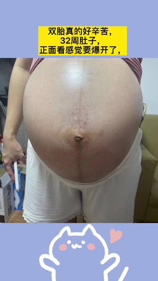 多胞胎孕妇临产巨肚 - 抖音