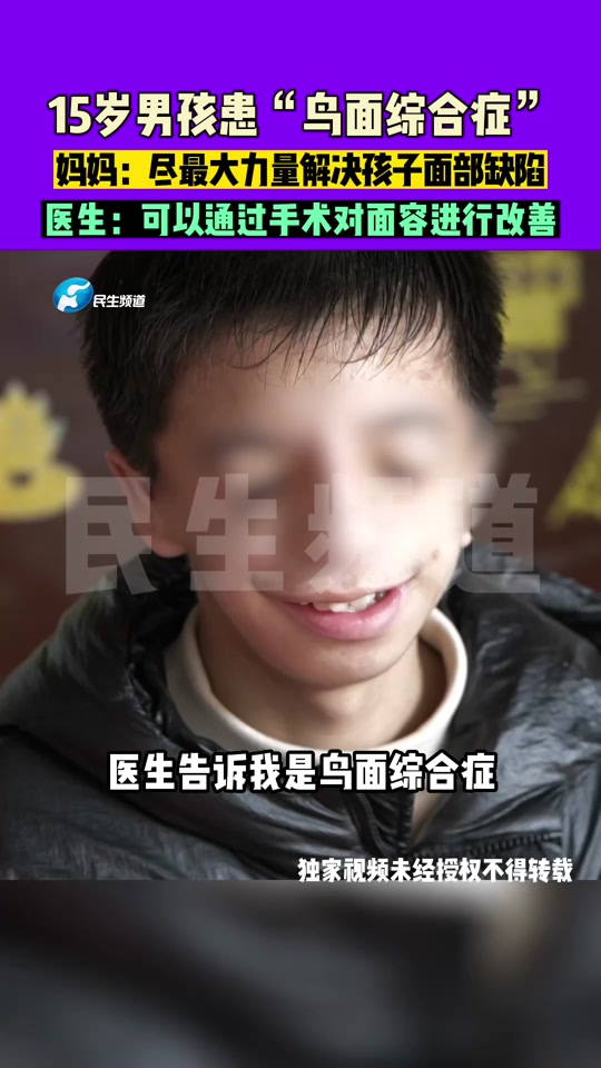 猫叫综合征患者面容