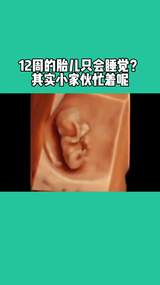 遵义悦好妇产医院:12周的胎儿,在妈妈肚子里的日常#遵义悦好四维 家属