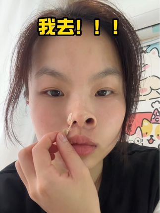 谁懂啊,我的妈呀!现在出门再也不怕不敢见人了#鼻翼大#内容过于真实 #种草 #变美小技巧 #懒人必备