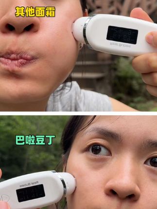 巴啦豆丁积雪草补水舒缓膏婴幼儿 润肤膏换季补水儿童面霜雪糕棒