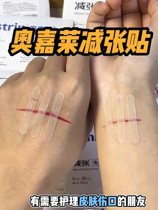 黑怕疤痕变大变丑的朋友,你就选这款奥嘉莱减张贴,真的有效果#医用减张贴 #奥嘉莱减张贴