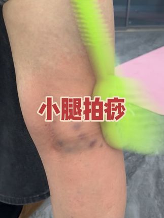 #拍痧板 #拍痧 #经络疏通 #养生 #健康