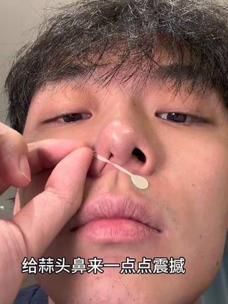 果然多刷手机就是能学到好东西!#鼻翼贴 #鼻翼大#自用分享