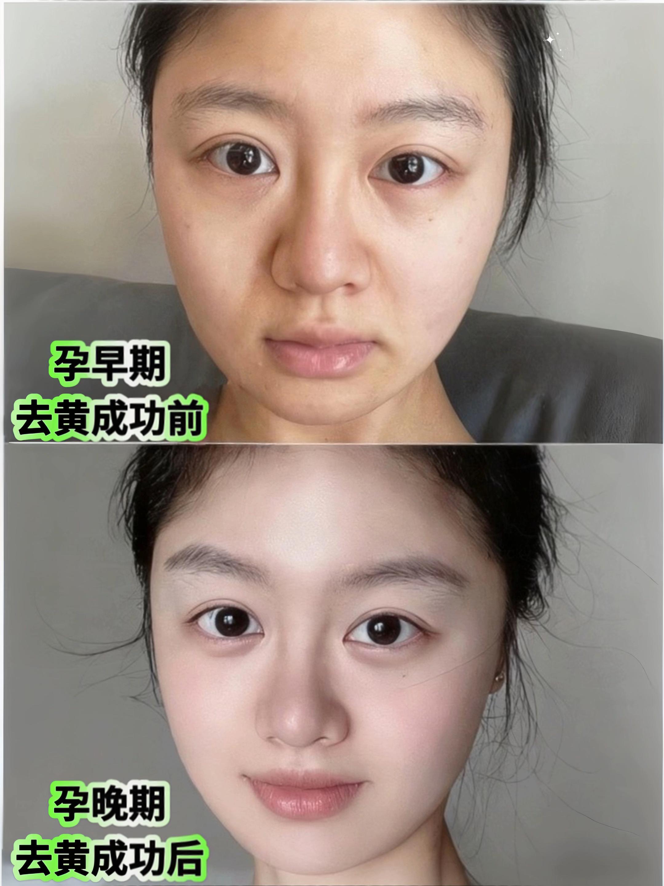 小孕妇们,孕期护肤可不能偷懒哦~#一个身体两个心跳 #孕期 #孕期护肤品 #孕妇面膜 #面膜推荐