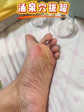#拔罐 #拔罐养生 #脚底拔罐 #无限回购的宝藏单品 #在抖音入手的好东西