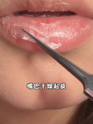 #孕期 嘴巴开始干巴巴还脱皮,又不能撕,孕妈朋友推荐入手了这个#袋鼠妈妈#润唇膏,每天早晚都会涂一涂真的巨滋润,也不会黏乎乎的,不仅孕期哺乳期,平时都可以用!#孕期囤货#唇膏