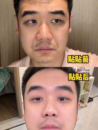 物理性脸部提升,面部提拉。#提拉紧致 #脸部提拉 #面部提升 窝去!!这个斜修打卡两个月