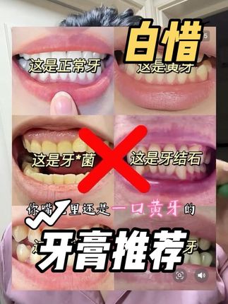 如果你还没用过抓紧拍回去试试#种草 #美白牙齿口气清新 #爱牙护牙 #牙膏推荐 #强烈推荐