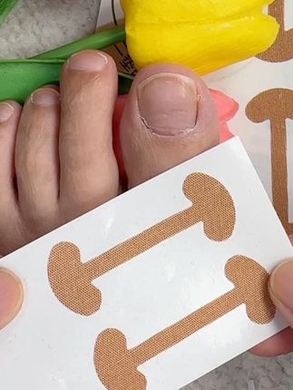 指甲扎进肉里可以试试这个矫正套装👉👉👉#创作者扶持计划 #原创视频 #好物推荐🔥 #脚指甲往肉里长怎么办 #嵌甲