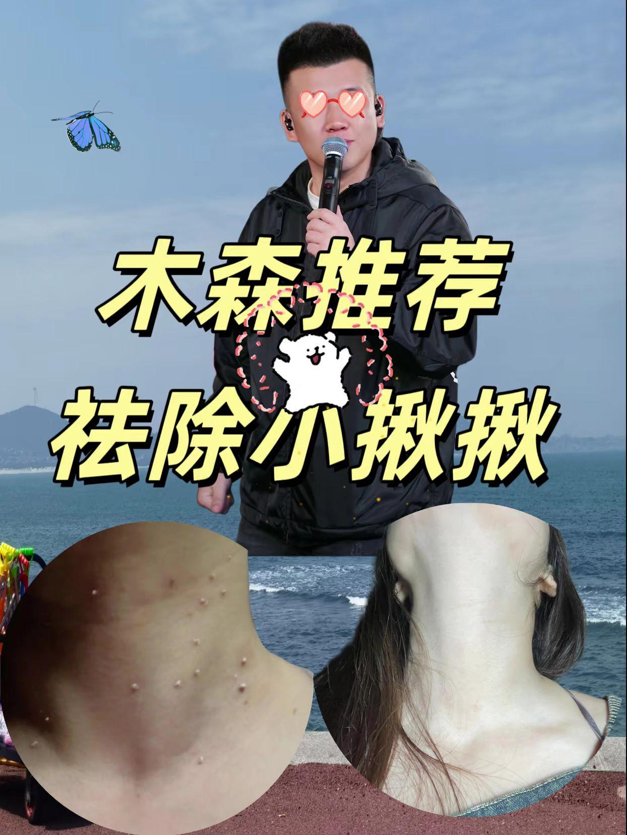 #今日分享#木森#木森大舞台
