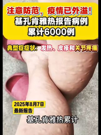 最近太吓人了兄弟们,我先买了,管他有没有用,先预防一下,至少心里舒服了#驱蚊 #基孔肯雅热 #蚊子 #防蚊必备 #防蚊必备