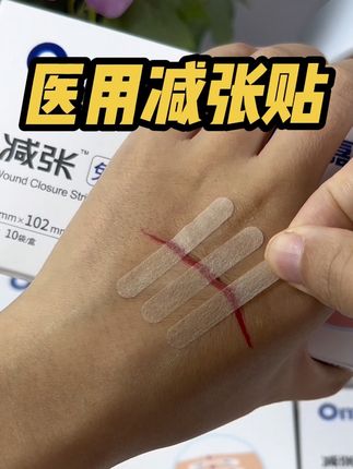 黑怕疤痕变大变丑的朋友,你就选这款奥嘉莱减张贴,真的有效果#医用减张贴 #奥嘉莱减张贴