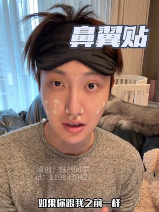 跟了我二十几年的蒜头鼻总算遇到对手了#蒜头鼻 #鼻翼贴 #小哑铃鼻翼贴 #鼻翼大 #鼻翼缩小
