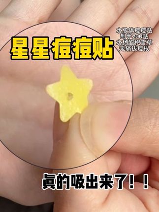 怪不得那些明星博主都贴的是这种星星痘痘贴,真的是又好看又能吸!!长痘怕留痘印的一定要去学会贴痘痘贴!#痘痘贴#油痘肌 #星星痘痘贴 #女生必备
