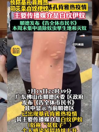 能灭花蚊子!灭蚊精确到秒!南方小伙伴一定要备上!#灭蚊 #灭蚊神器