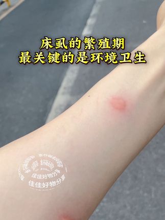 床虱、臭虫、跳蚤的克星杀虫喷射剂#床虱 #跳蚤 #臭虫